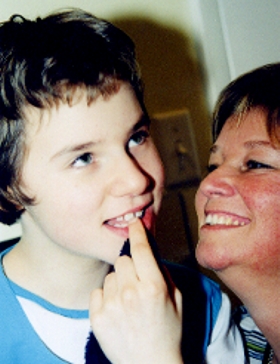 Dyspraxia - Movement Difficulties photo