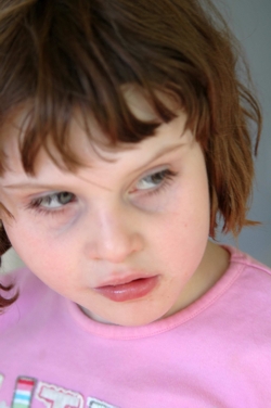 diagnosis of ASD photo